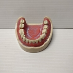 Lower Model with 9 Fixed Teeth Epoxy Must Be Fitted for the MQDT Tray